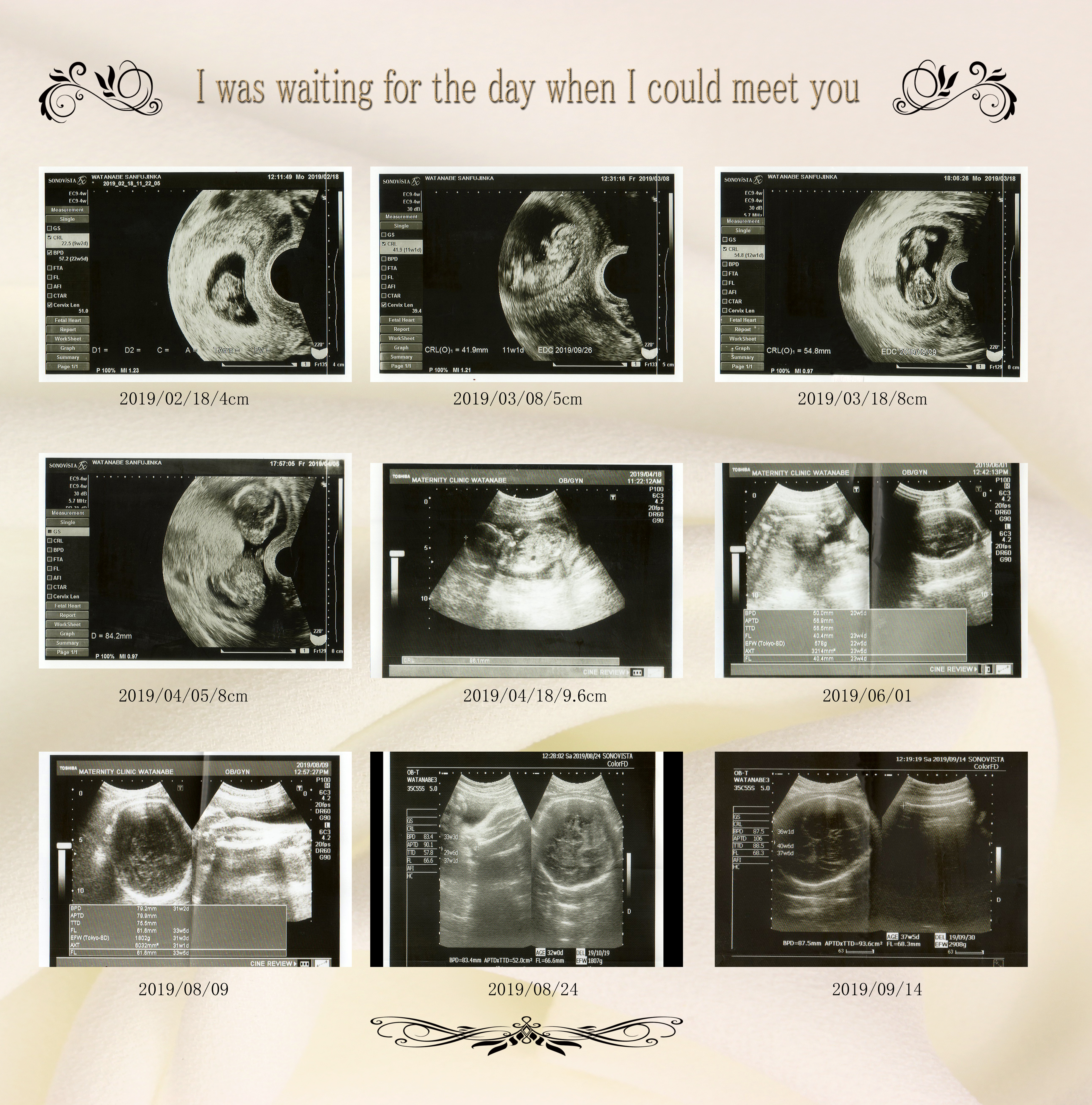 エコーアルバム Aタイプ Memoria