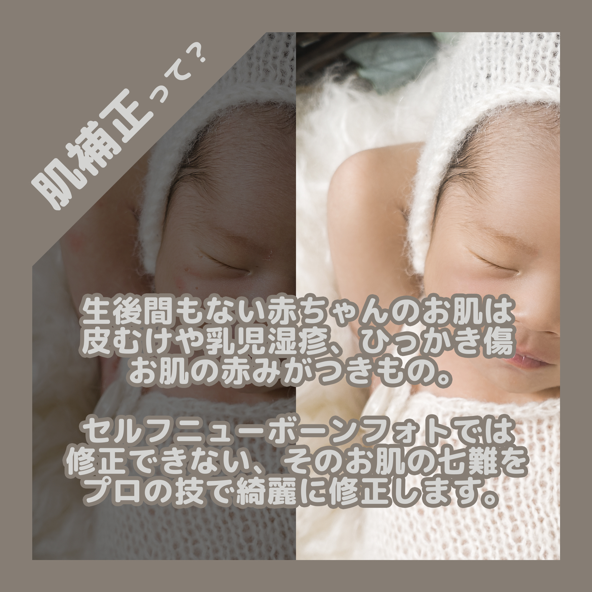 セルフニューボーンフォトの赤ちゃんの肌補正 プロによる補正 治らなかった乳児湿疹 赤み 皮むけに ニューボーンフォト 撮影グッズレンタルショップ Newborn Rental