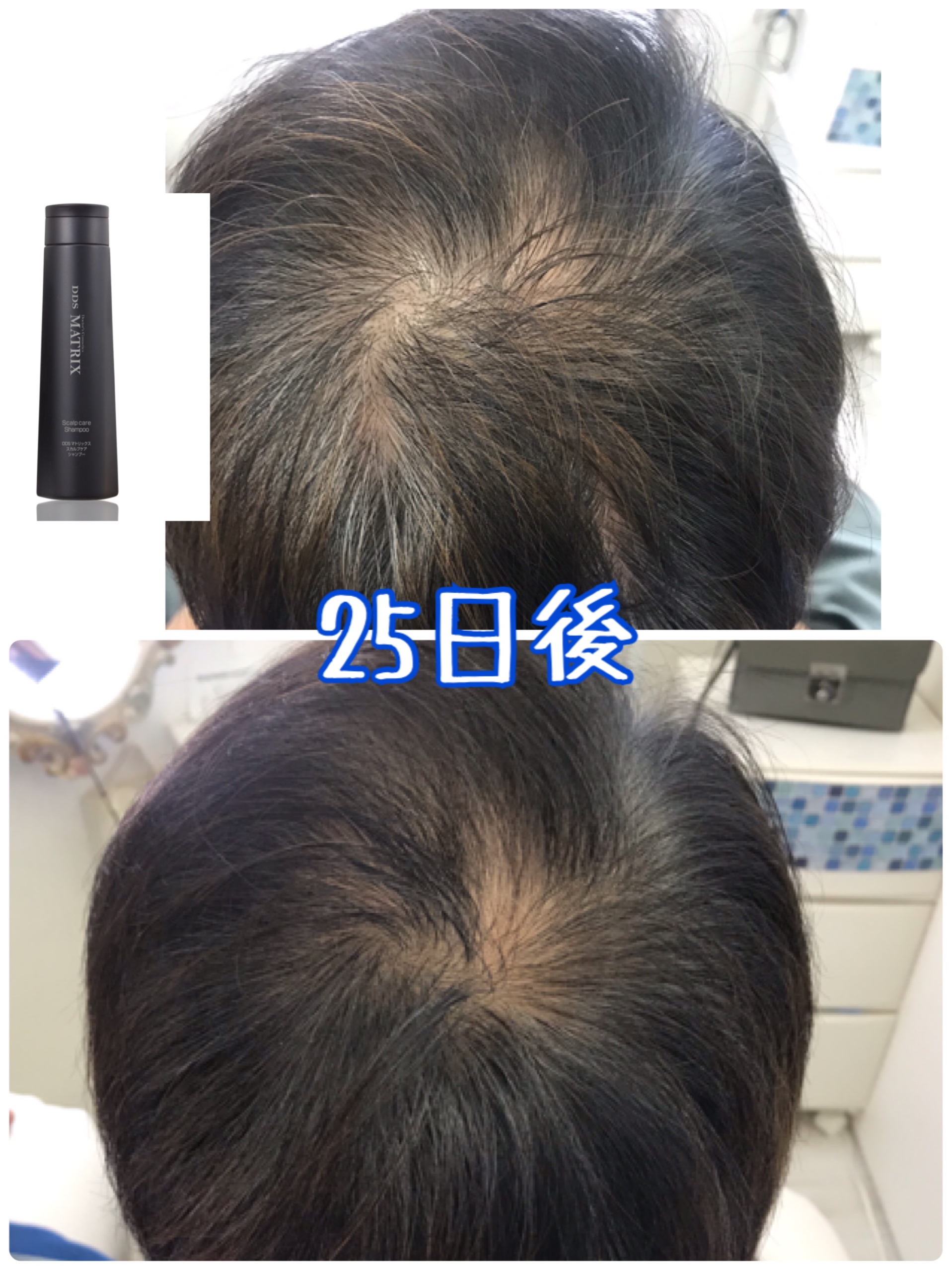 dds マトリックス