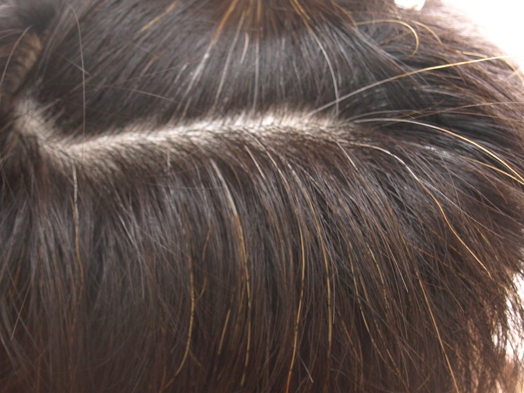 ごま油ケアで、夏の紫外線から受ける頭皮とヘアのダメージを ...