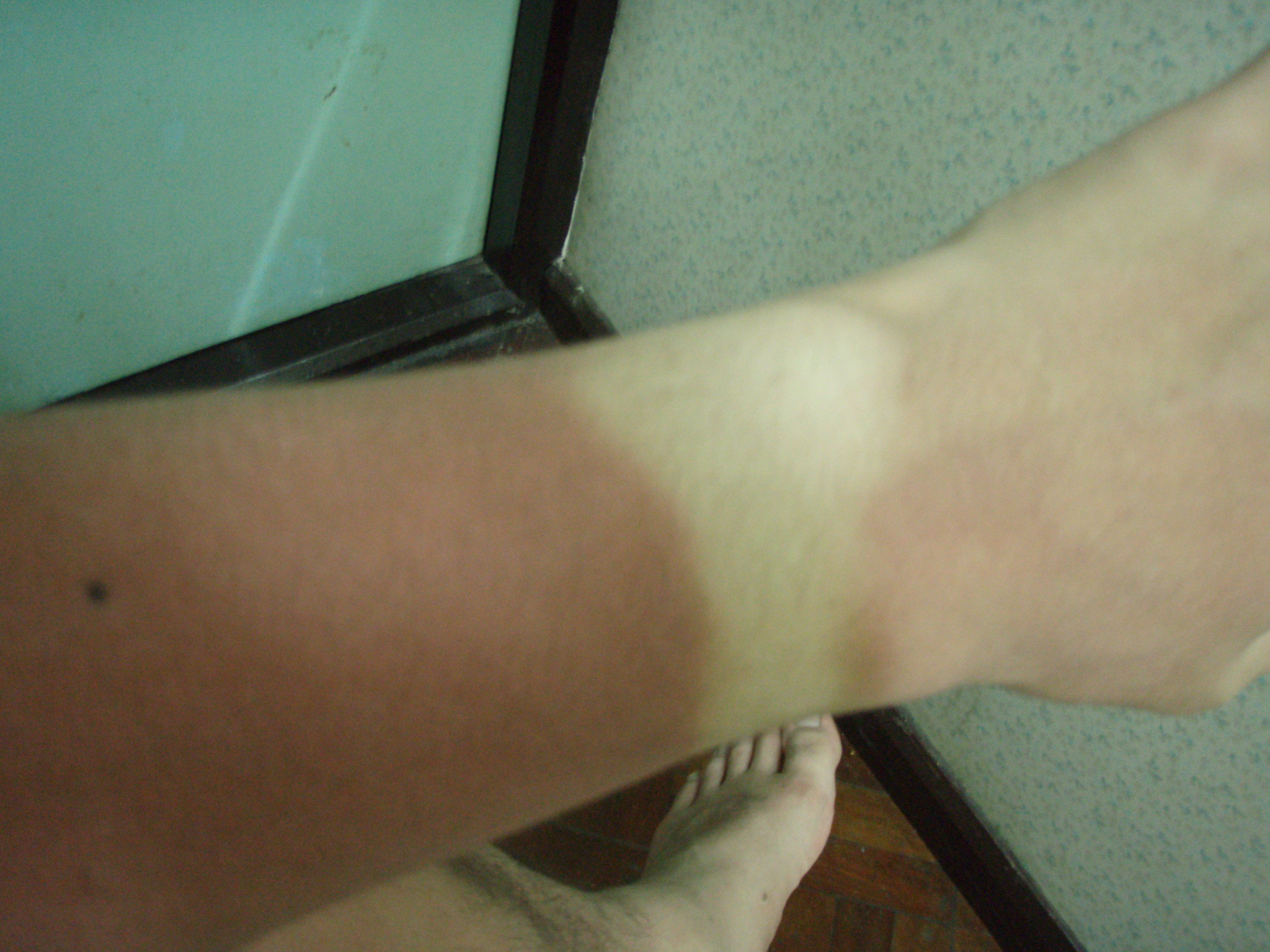 日焼け止め話その２ Monster Base