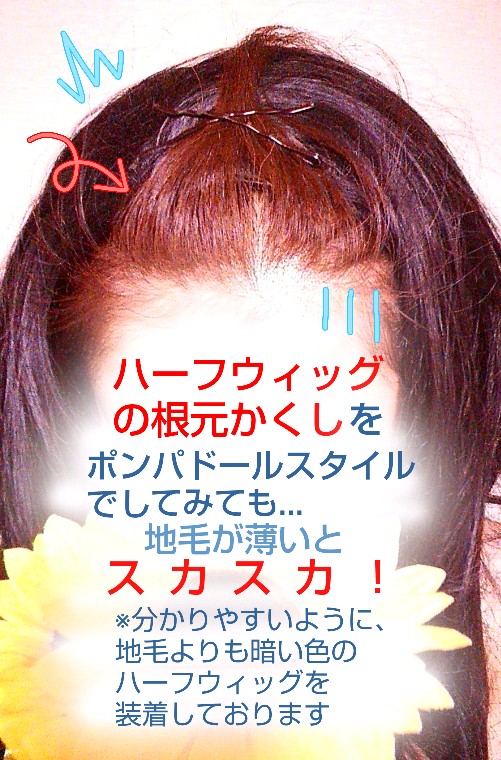 ぱっちん使用例 ハーフウィッグ ぱっちんカチューシャのvortex