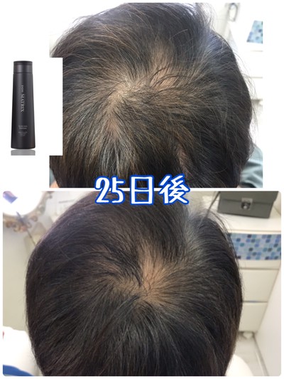 再生医療のddsマトリックススカルプケアシャンプーってどんなの 試してみました Base Mag