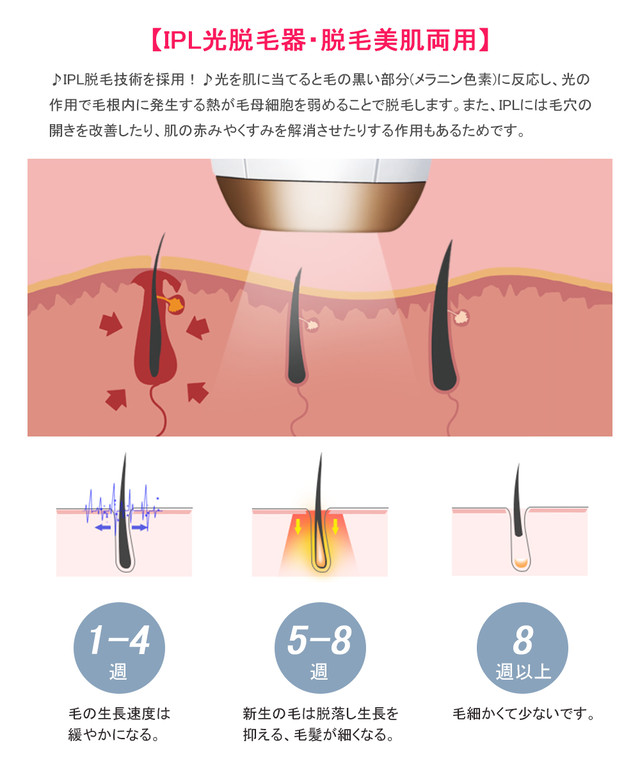 最新モデル 1年保障付 脱毛器 Ipl光脱毛器 家庭用脱毛器 メンズ 脱毛美顔器 脱毛機 脇 顔 太腿 全身脱毛 レディース 男女兼用 フラッシュ式 脱毛器 自宅 安全 99万回照射 Ammi