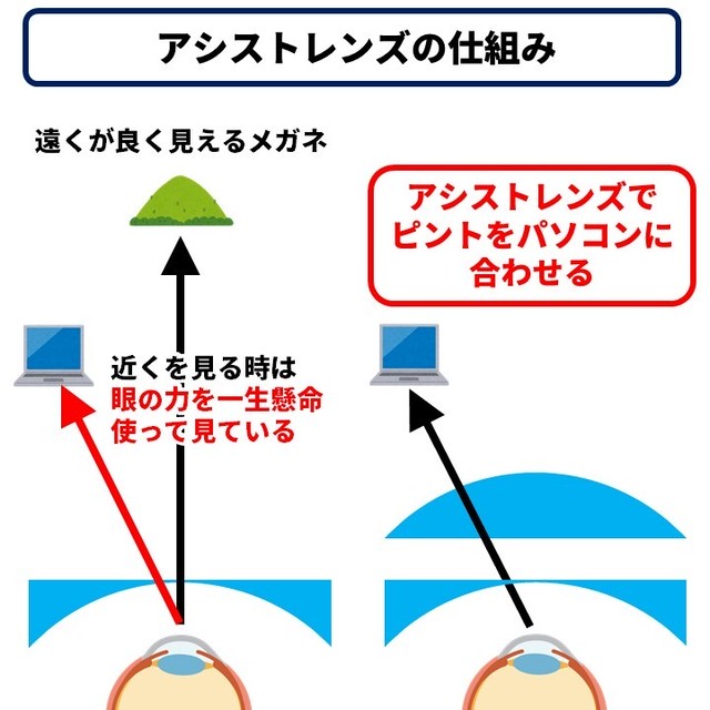 ピント調節クリップオン オーダーメイドタイプ サカタメガネオンライン