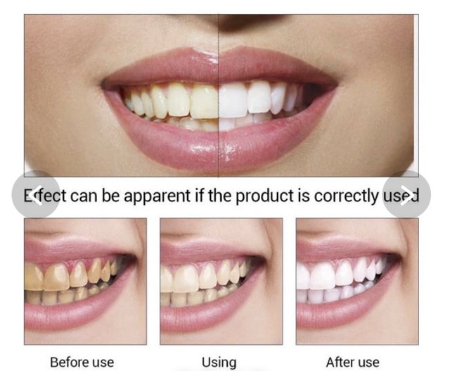 Lanbena 無添加セルフホワイトニング Next Step