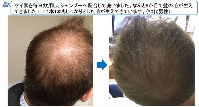 お肌が 美肌に変わる世界初の 植物性ケイ素濃縮液 ライスシリカ ミネラル水で 糖尿病 血糖値 コレステロール 尿酸 の改善に Kマート 足立ネット広告