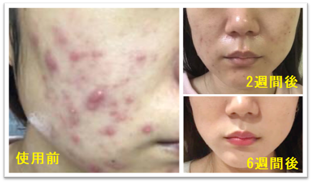 sd105 朝の洗顔クレンジングフォーム 毛穴美白 くすみ改善 Sodajima化粧品オンラインshop