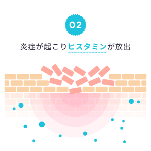 バストップケアは 日常生活に於いても下着の絞め付け 下着と皮膚の擦れ具合 アレルギー等 医学的な場合は 婦人科の医者へ Sitifukujin