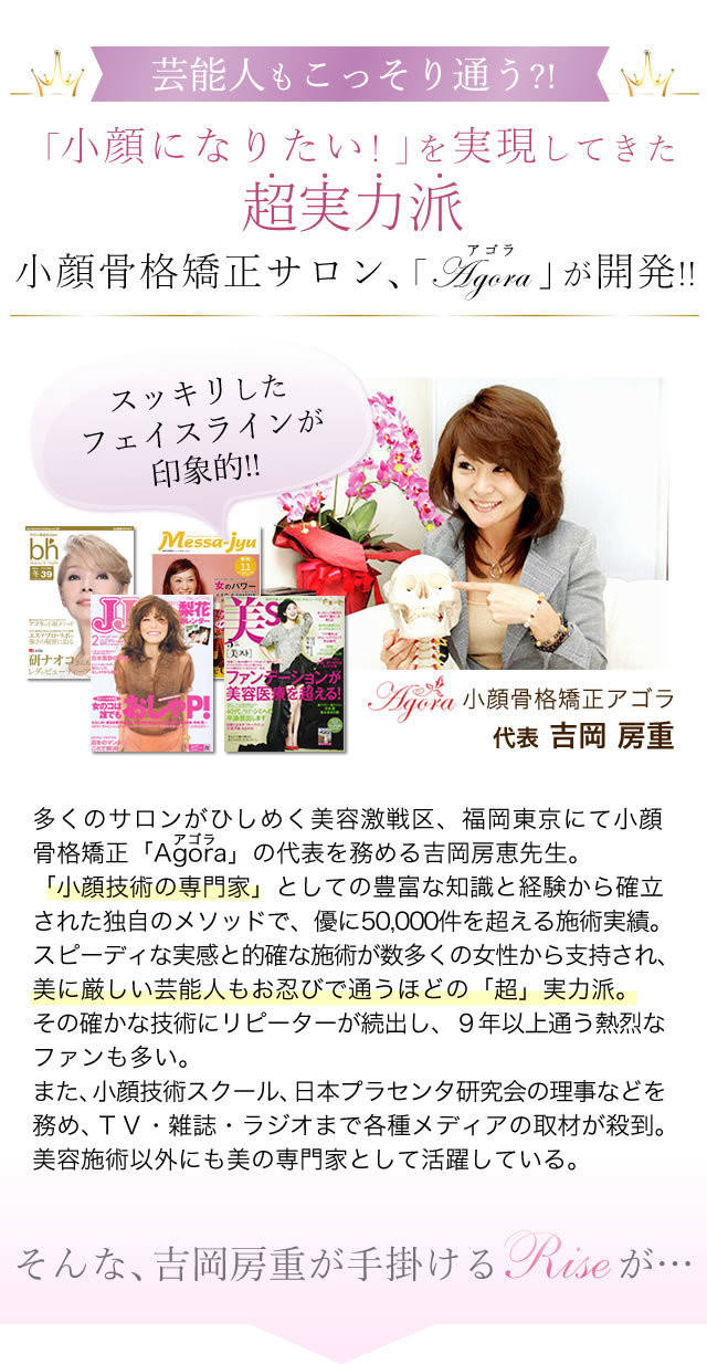 小顔ジェル Rise ストレッチゴールド Lovenus