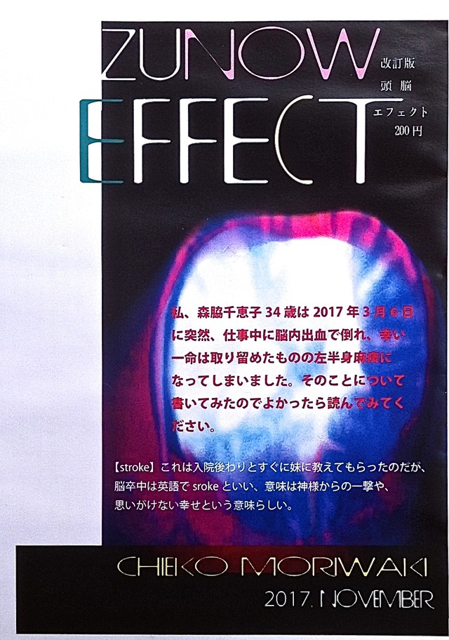 Zunow Effect 改定版 She Says Distro