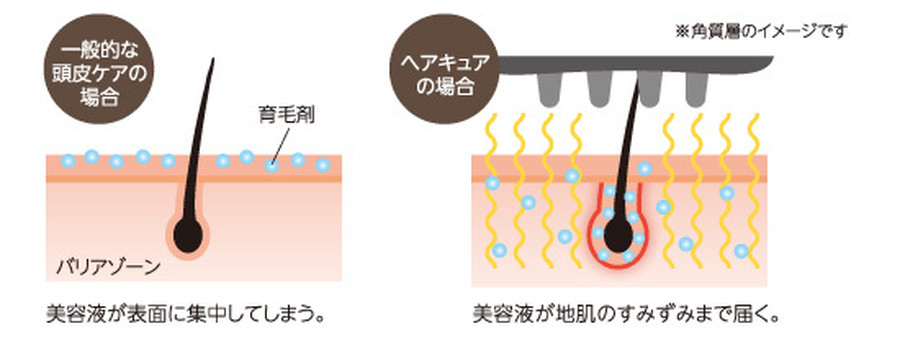 発毛力全開！電子パルス・ヘアキュア | 髪を育てるシャンプー